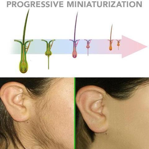 Organic Herbal Hair Growth Inhibitor