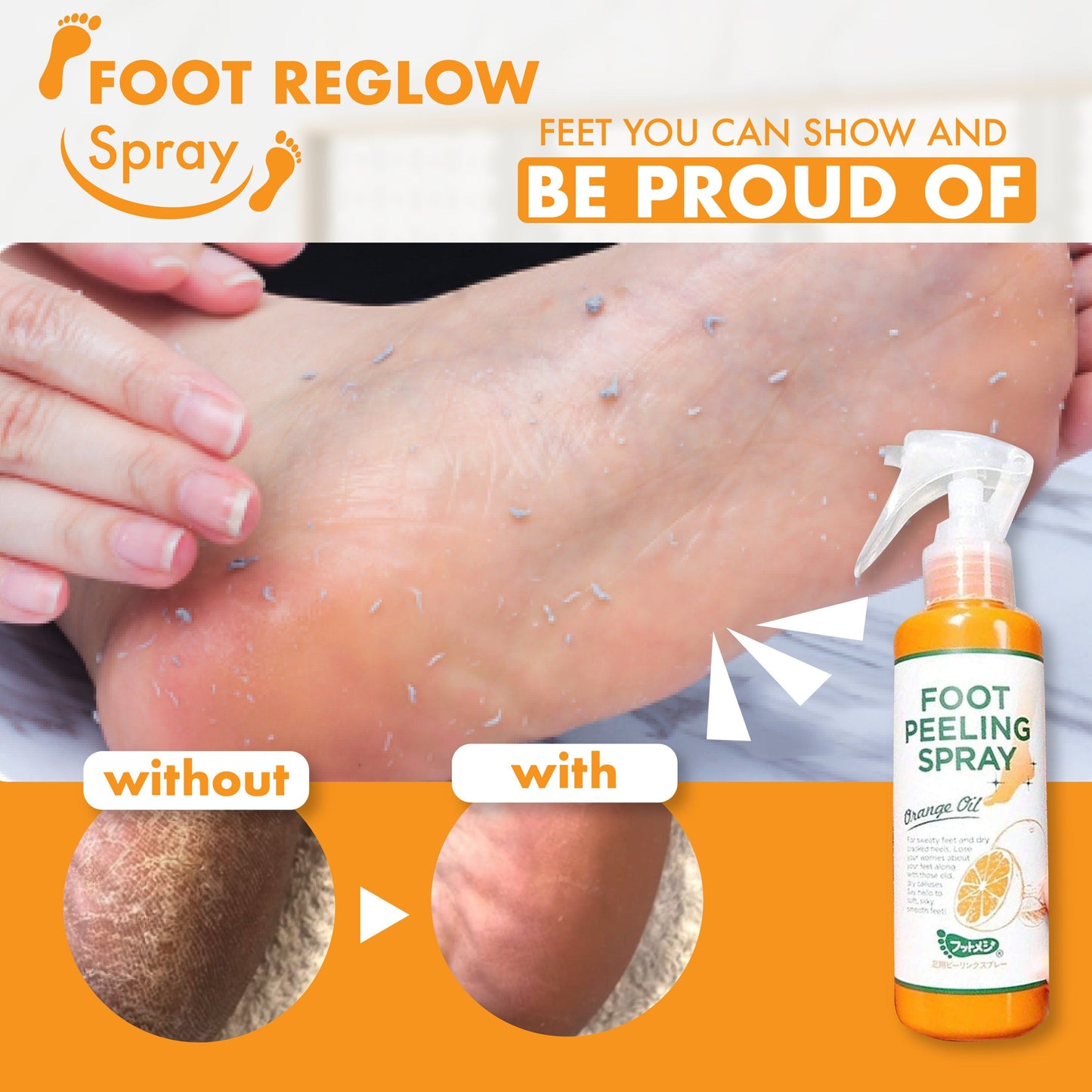 [Promotion Sale!] Callus Off Foot Reglow Spray
